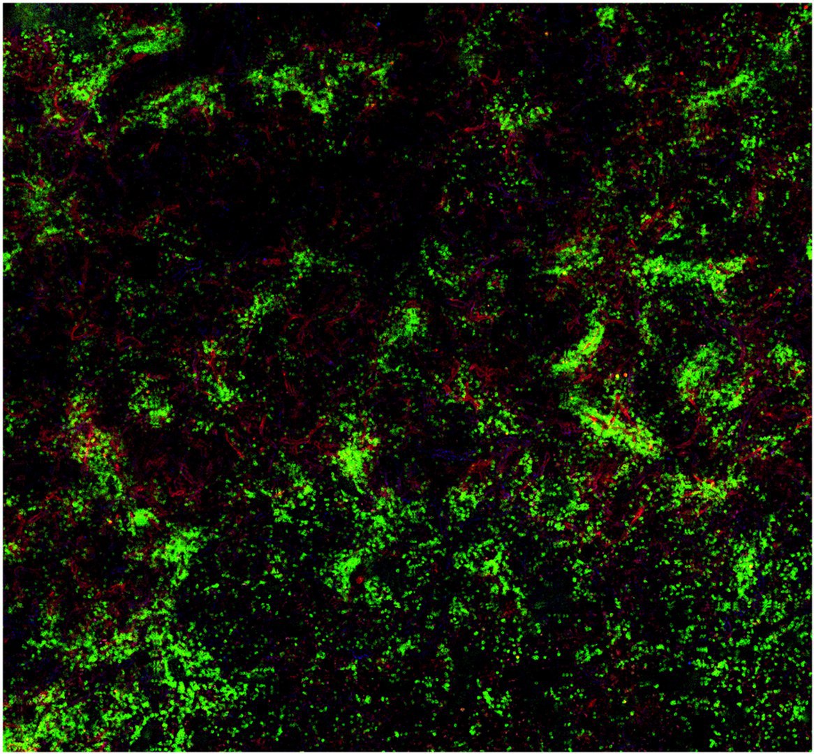 Gewebeprobe aus der Milz einer Maus: - Die B-Zellen (grün) interagieren mit Faktor VIII (rot).