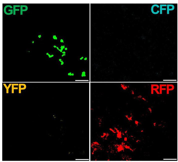 Die Vermehrung von mononukleären Phagozyten (MNP) - führt zur Bildung von Zellclustern in der Niere. Dies zeigen grünfluoreszierende Proteine (links oben) und rot-fluoreszierende Proteine (rechts unten).
