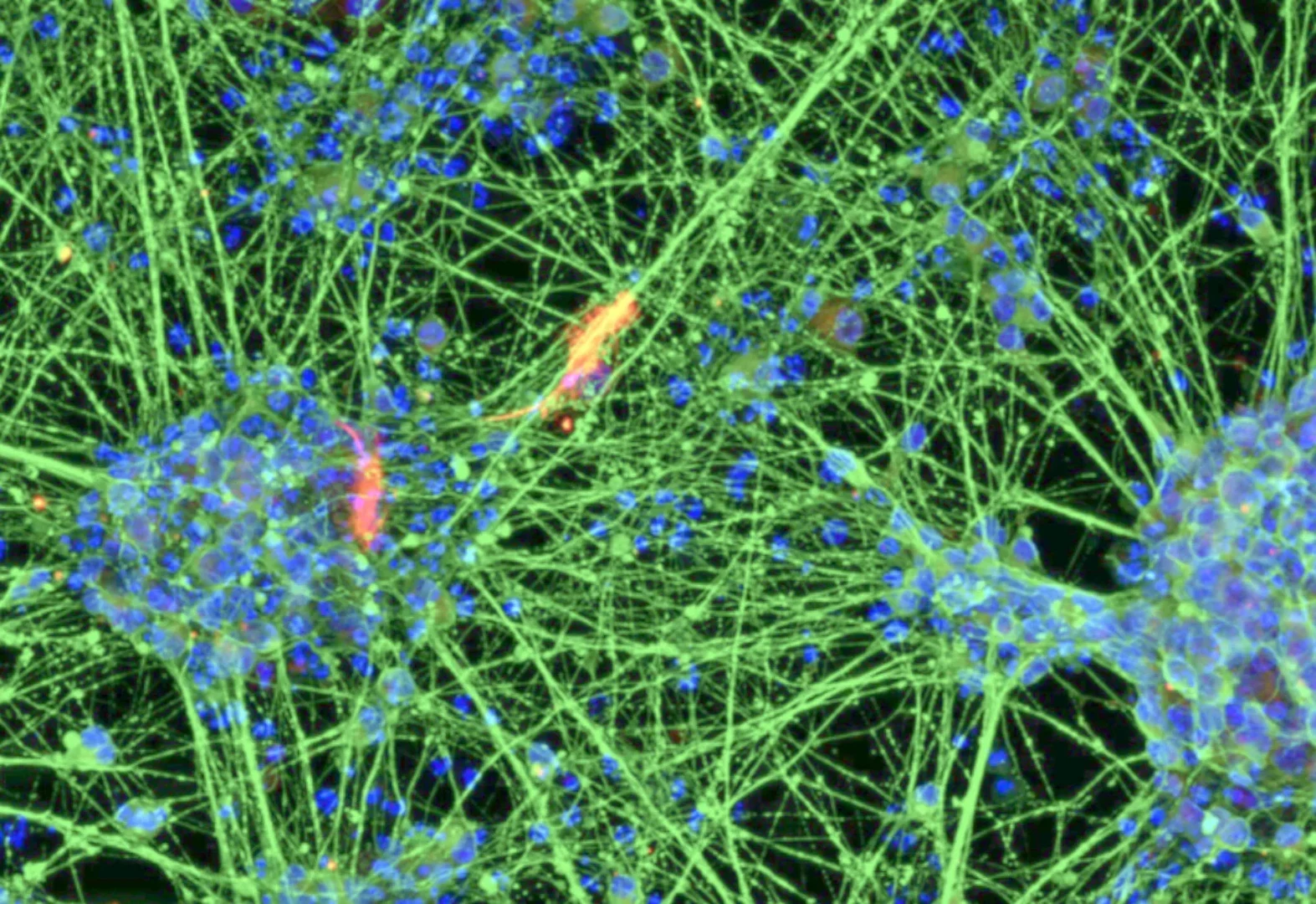 Nervenzellen, - erzeugt durch Differenzierung von aus dem Blut gewonnenen induzierten neuralen Stammzellen (iNSC).