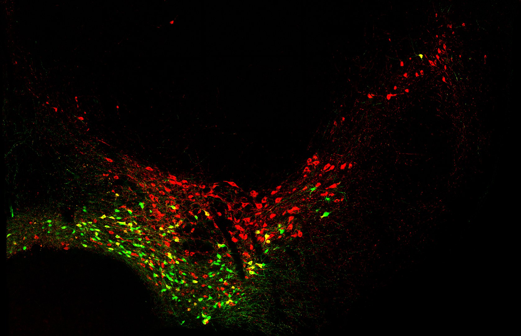 Die Rotfärbung - macht sämtliche dopaminergen Neuronen des Mittelhirns einer Maus sichtbar. Grün leuchten dagegen nur diejenigen dopaminergen Nervenzellen auf, die relativ spät in der Embryonalentwicklung entstanden sind.