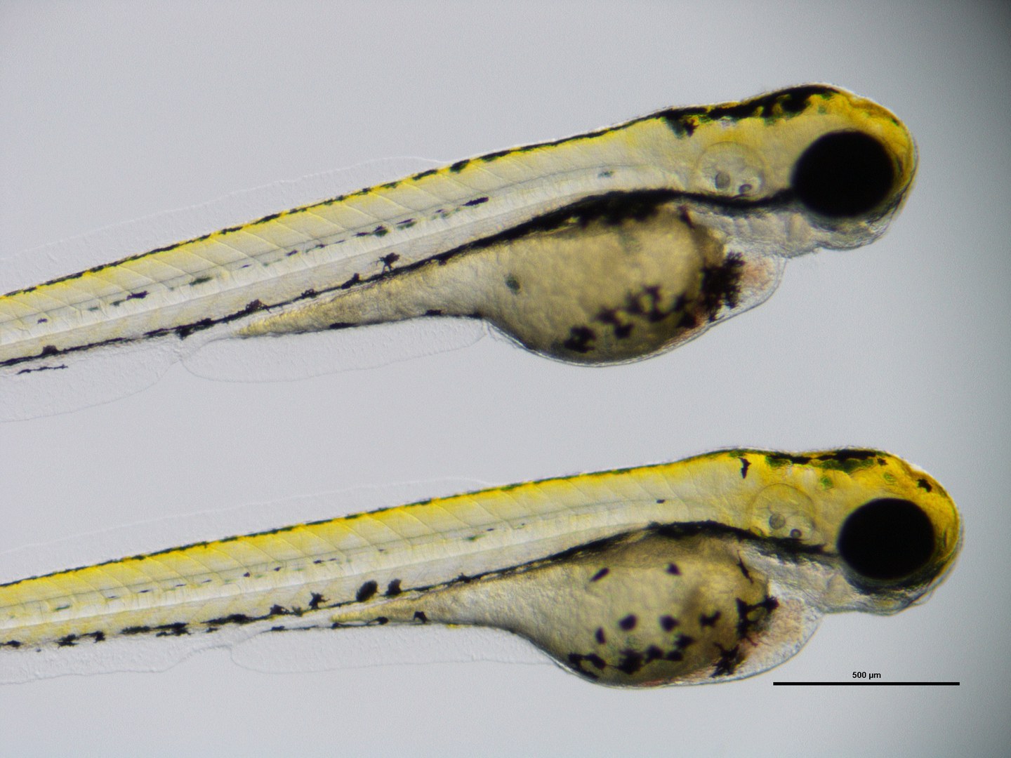 Zebrafisch-Larven - Zwei lebendige Zebrafischlarven, in denen das Fisch-SHROOM4-Gen ausgeschaltet wurde. Man erkennt entsprechende Fehlbildungen (kleine Augen, kleine Köpfe, Anomalien des Darms, Hinweise auf Herzfehler).