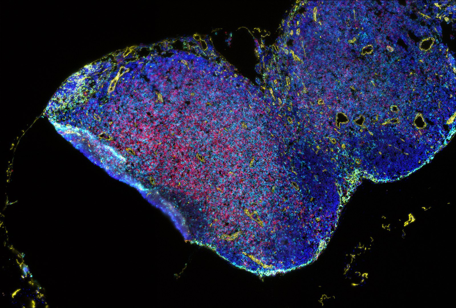 Lymphknoten der Maus: - Die Farben stehen für Fluoreszenzmarker, die an spezifische Moleküle auf der Oberfläche oder im Inneren einzelner Immunzellen binden. Im Projekt sind Analysen ähnlicher Bilder von Patienten geplant, die über Art und Positionierung von Immunzellen in der Nähe von Tumorzellen Aufschluss geben.