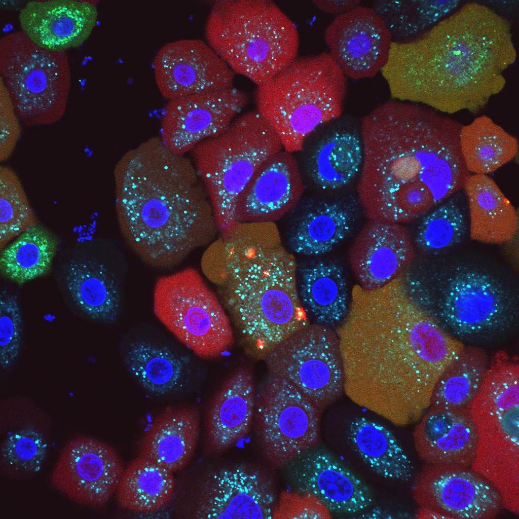 Werden die Mitochondrien (hellblau) geschädigt, - schlägt der NLRP10-„Rauchmelder“ Alarm und formiert sich mit anderen Proteinen zu einem Inflammasom (rot). Letztlich führt das zum Untergang der Zelle und ihrer Entsorgung.