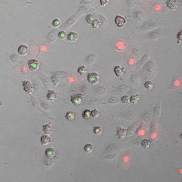Hautzellen - In Hautzellen des Menschen werden als Folge einer ribotoxischen Stressantwort Inflammasomen (grün) zusammengebaut. Durch die „Löcher“, die diese erzeugen, strömt anschließend roter Farbstoff in die Zelle.