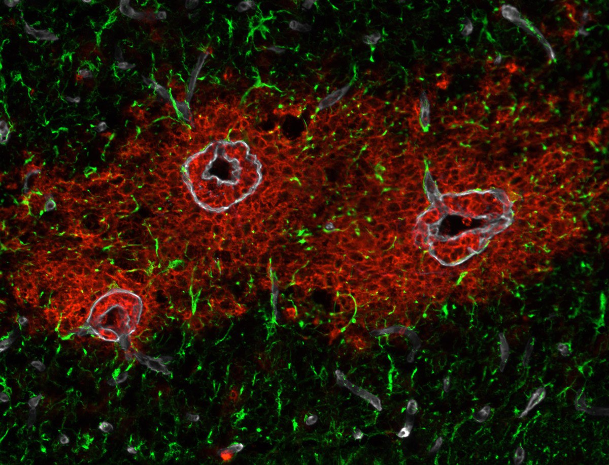 Im Mikroskop-Bild sind Astrozyten grün und Immunzellen rot gefärbt. Die Basalmembranen der Gefäße sind in weiß zu sehen