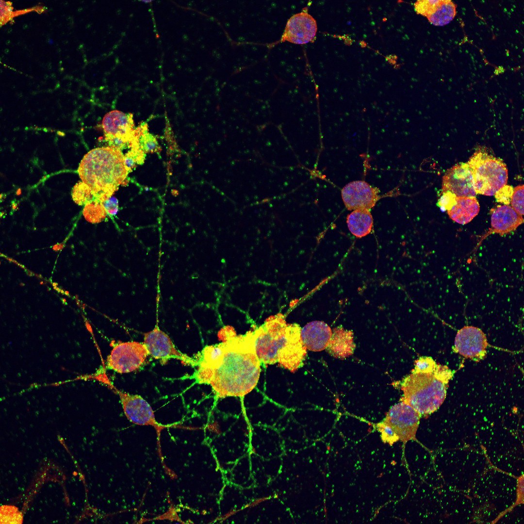 Die Antikörper gegen Casein (rot) binden im Gehirn an MAG (grün).