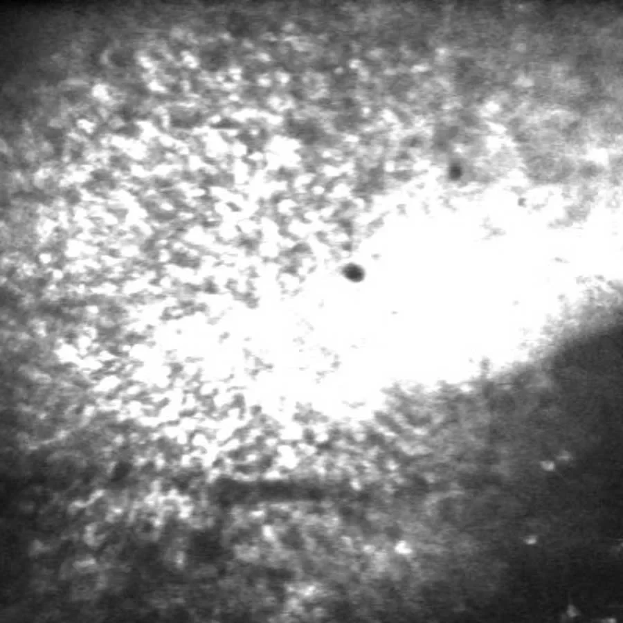 Fluoreszenzmikroskopie: Aufnahme langsamer Depolariationswellen, sogenannte Spreading Depolarization (SD), nach einem epileptischen Anfall.