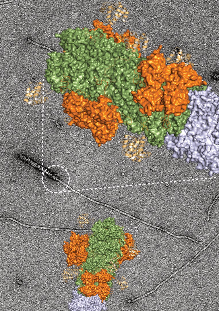 Elektronenmikroskopische Aufnahme - des Übergangs zwischen dem Gefahrensensor NLRP3 und seinem Signalprotein, dargestellt in der Vergrößerung mit der berechneten Proteinstruktur.
