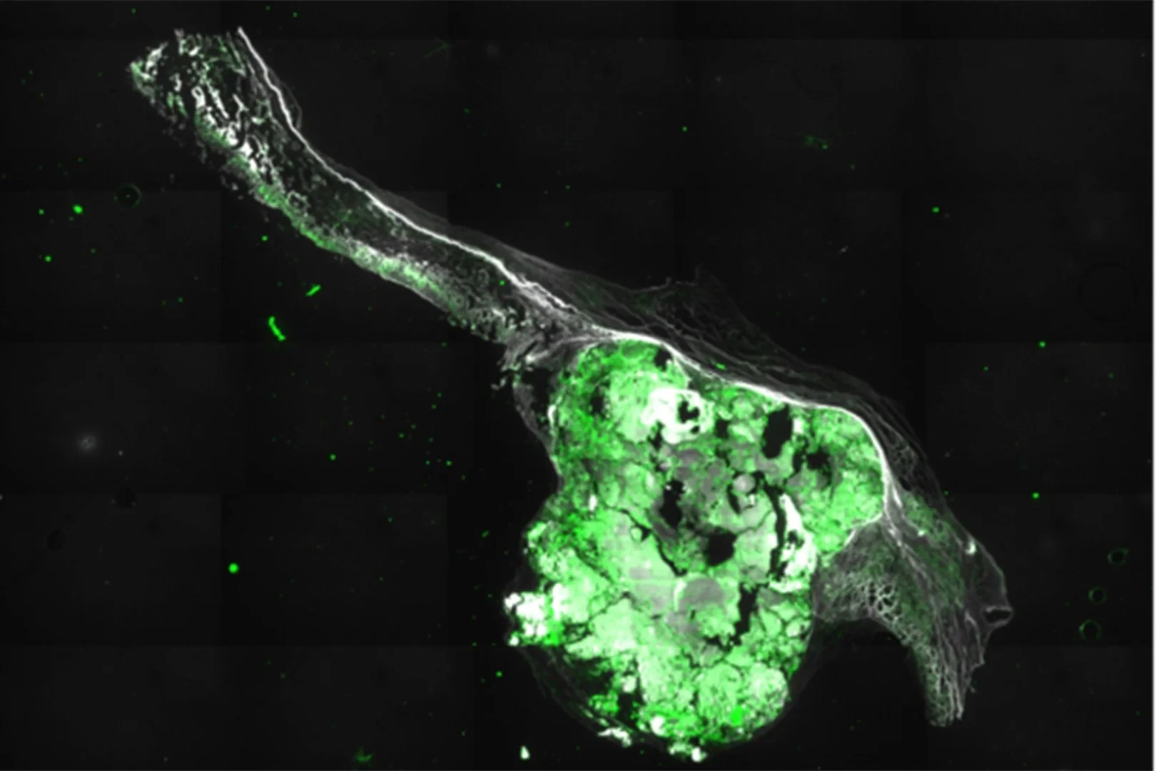 Immunfluoreszenz-Färbung des Schnitts einer menschlichen Aortenklappe mit drei Segeln: - Die Farben zeigen verschiedene markierte Proteine, die für die Krankheitsentstehung von Bedeutung sind.