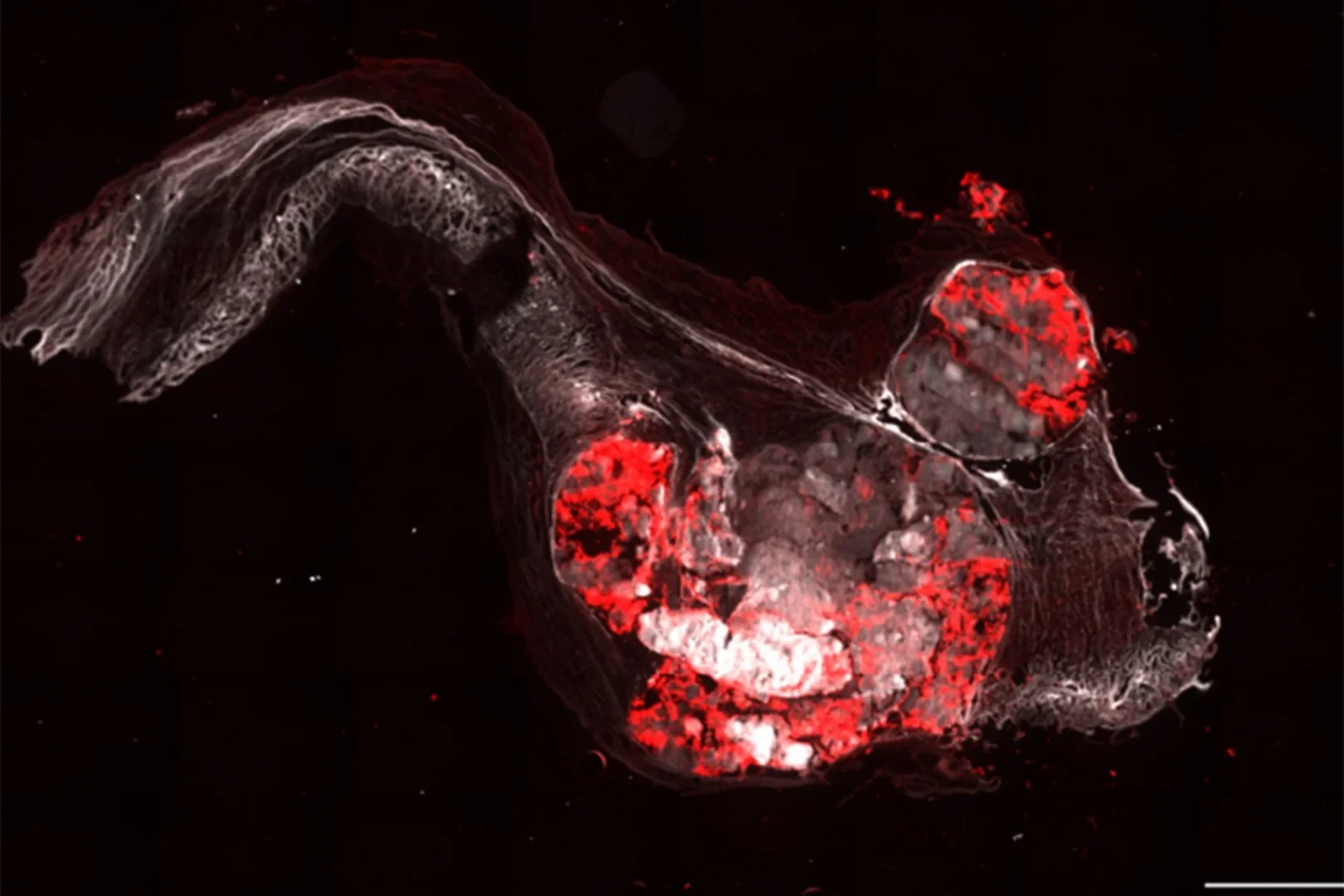 Immunfluoreszenz-Färbung des Schnitts einer menschlichen Aortenklappe mit zwei Segeln: - Die Farben zeigen verschiedene markierte Proteine, die für die Krankheitsentstehung von Bedeutung sind.