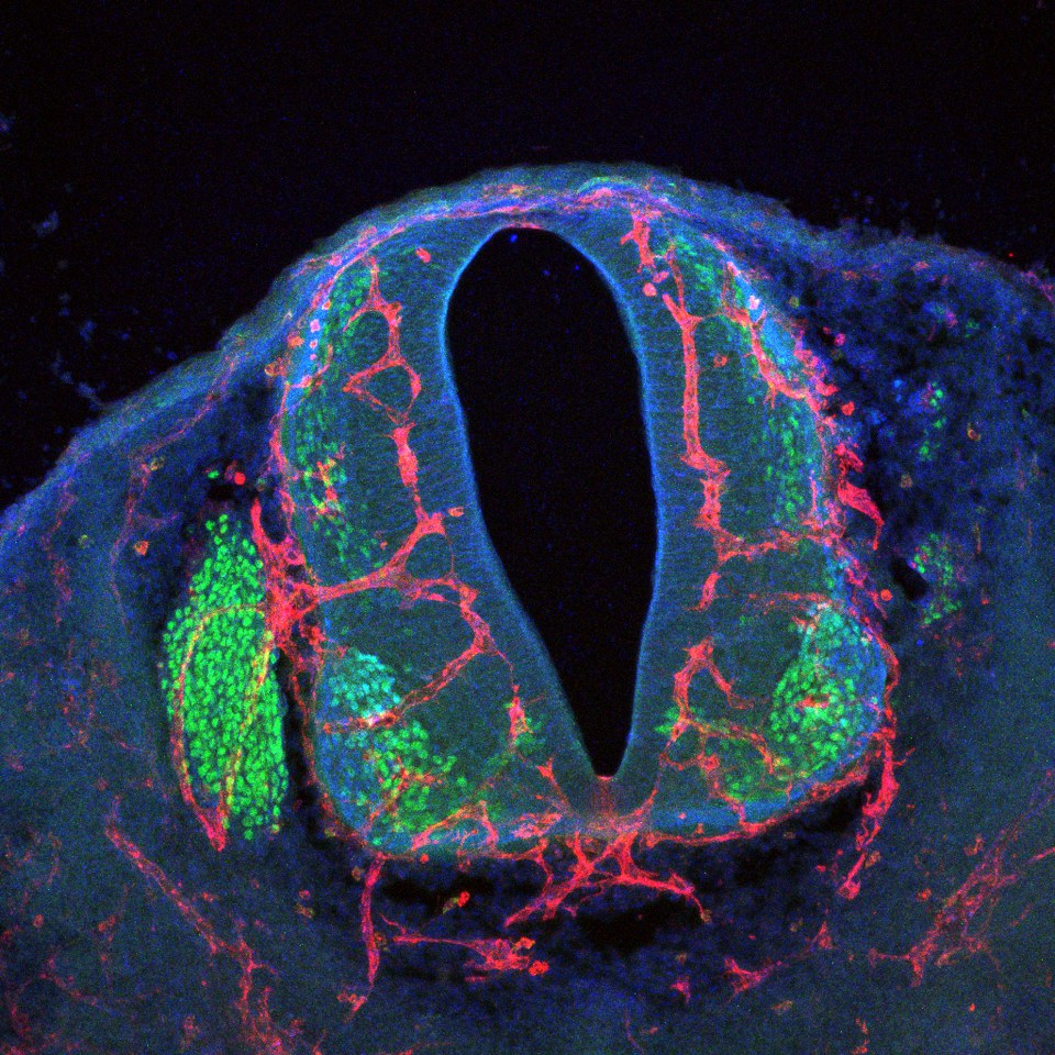Wenn das PlexinD1-Gen nicht funktioniert, - wandern die Blutgefäße (rot) auf unorganisierte Weise in Regionen mit Motorneuronen (grün) ein.