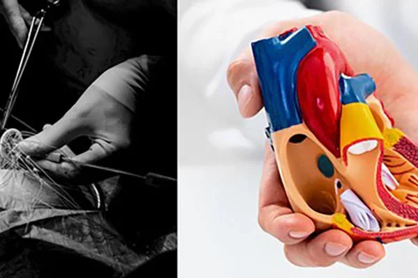 Beispielbild Herzklappen.jpeg