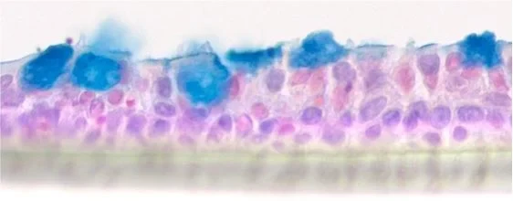 Air-liquid interface culture of human bronchial epithelial cells: - Alcian blue staining shows the mucus-producing goblet cells.