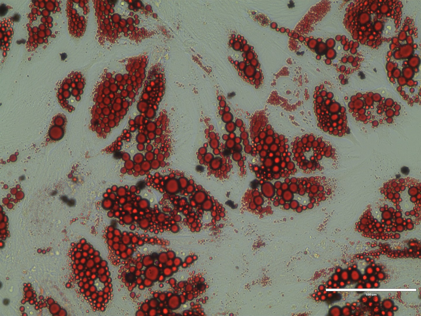 Human brown adipocytes, lipid stained red (RedO oil stain)