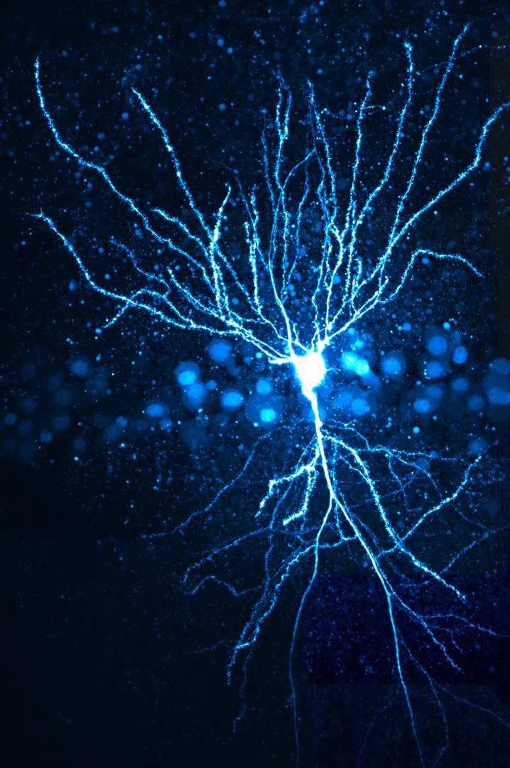 Place cell of the mouse: The dendrites are easily recognizable thanks to the blue fluorescence staining. This is where location information is integrated.